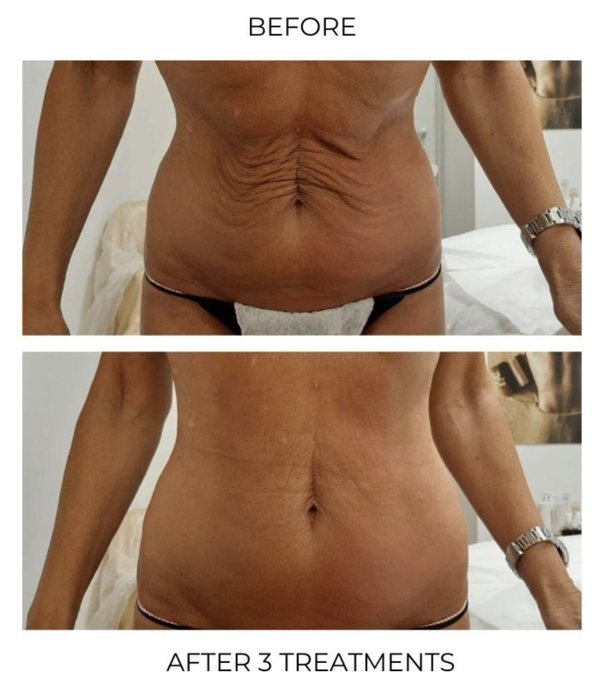 Custom facials for all skin types at Roses & Wallflowers Esthetics