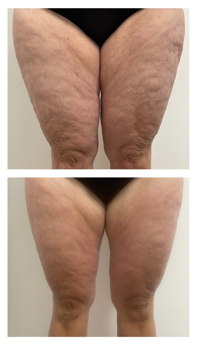 Custom facials for all skin types at Roses & Wallflowers Esthetics